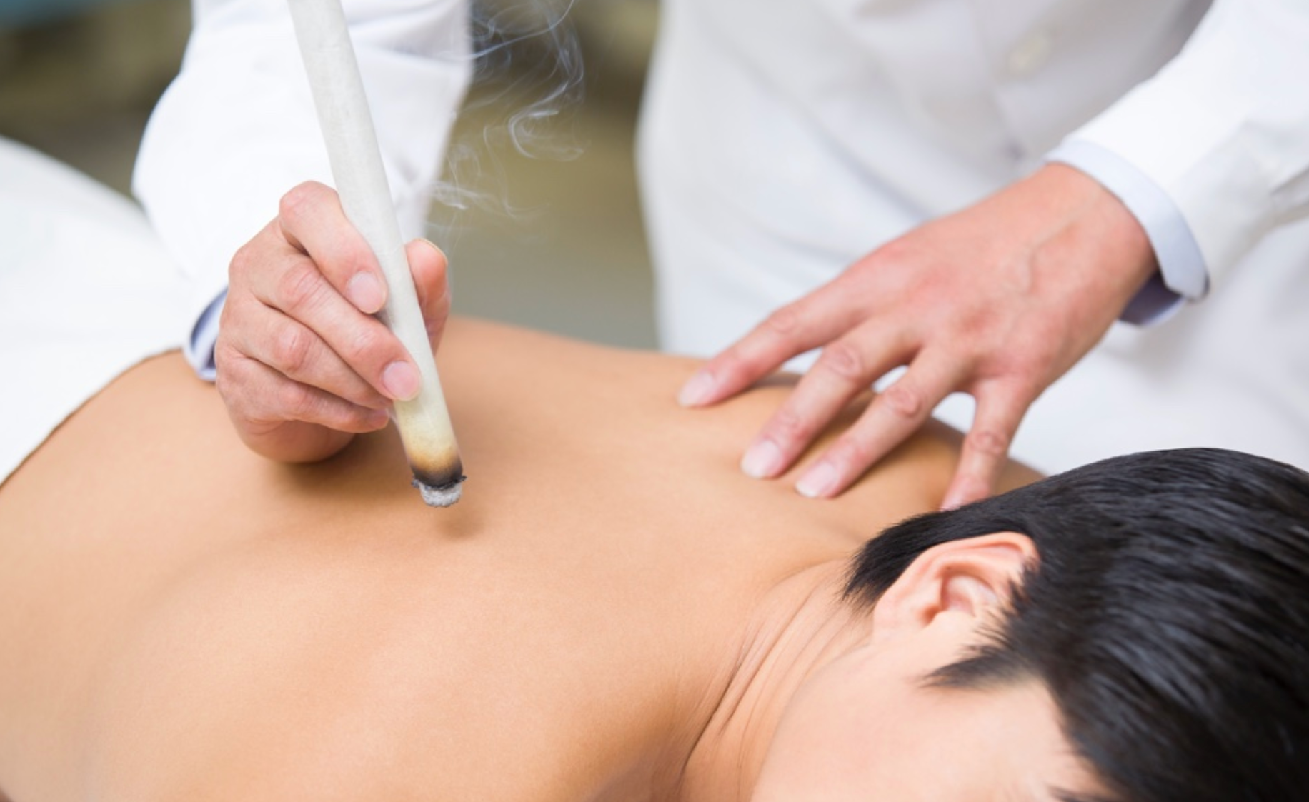 Person receiving traditional Chinese moxibustion therapy
