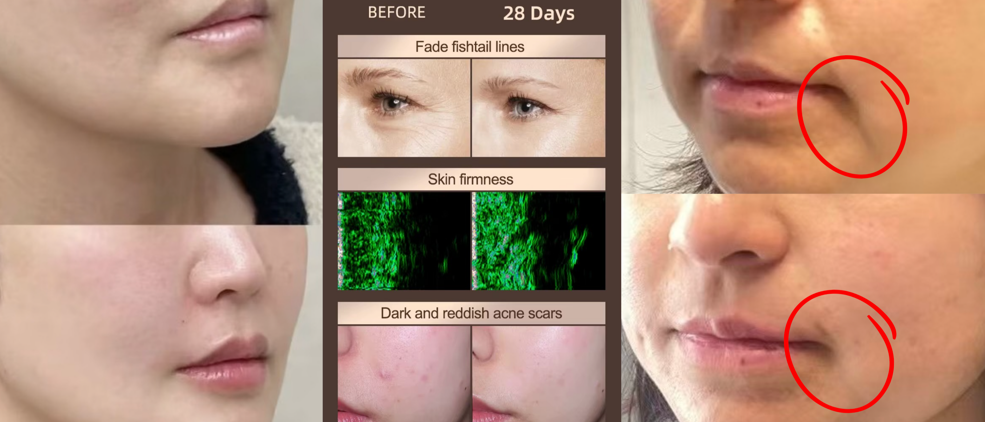 Before and after skin treatment results showing improvements in facial lines, skin firmness, and acne scars.